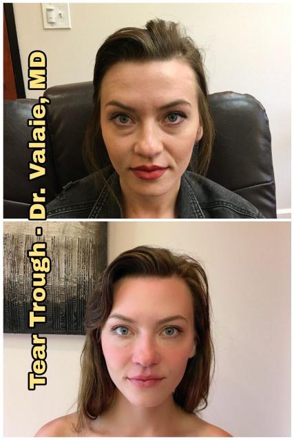 before after sample